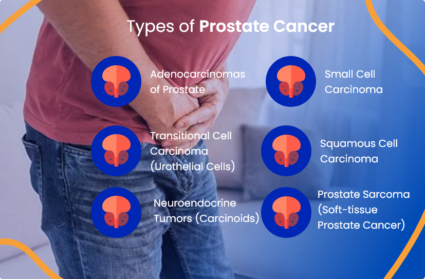 Types of Prostate cancer